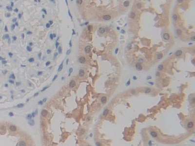 Polyclonal Antibody to Purinergic Receptor P2X, Ligand Gated Ion Channel 7 (P2RX7)