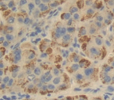 Polyclonal Antibody to Absent In Melanoma 1 (AIM1)
