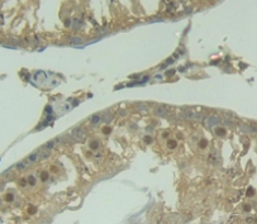 Polyclonal Antibody to Absent In Melanoma 2 (AIM2)