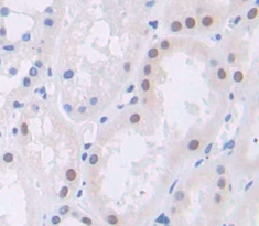Polyclonal Antibody to Polybromo 1 (PBRM1)