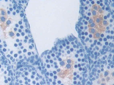 Polyclonal Antibody to Osteocrin (OSTN)