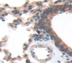 Polyclonal Antibody to Mesothelin (MSLN)