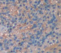 Polyclonal Antibody to IL2 Inducible T-Cell Kinase (ITK)