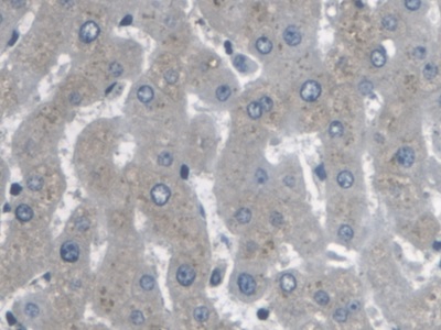 Polyclonal Antibody to Actin Related Protein 2/3 Complex Subunit 4 (ARPC4)