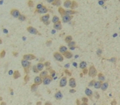 Polyclonal Antibody to Cbp/p300 Interacting Transactivator, With Glu/Asp Rich Carboxy Terminal Domain 1 (CITED1)