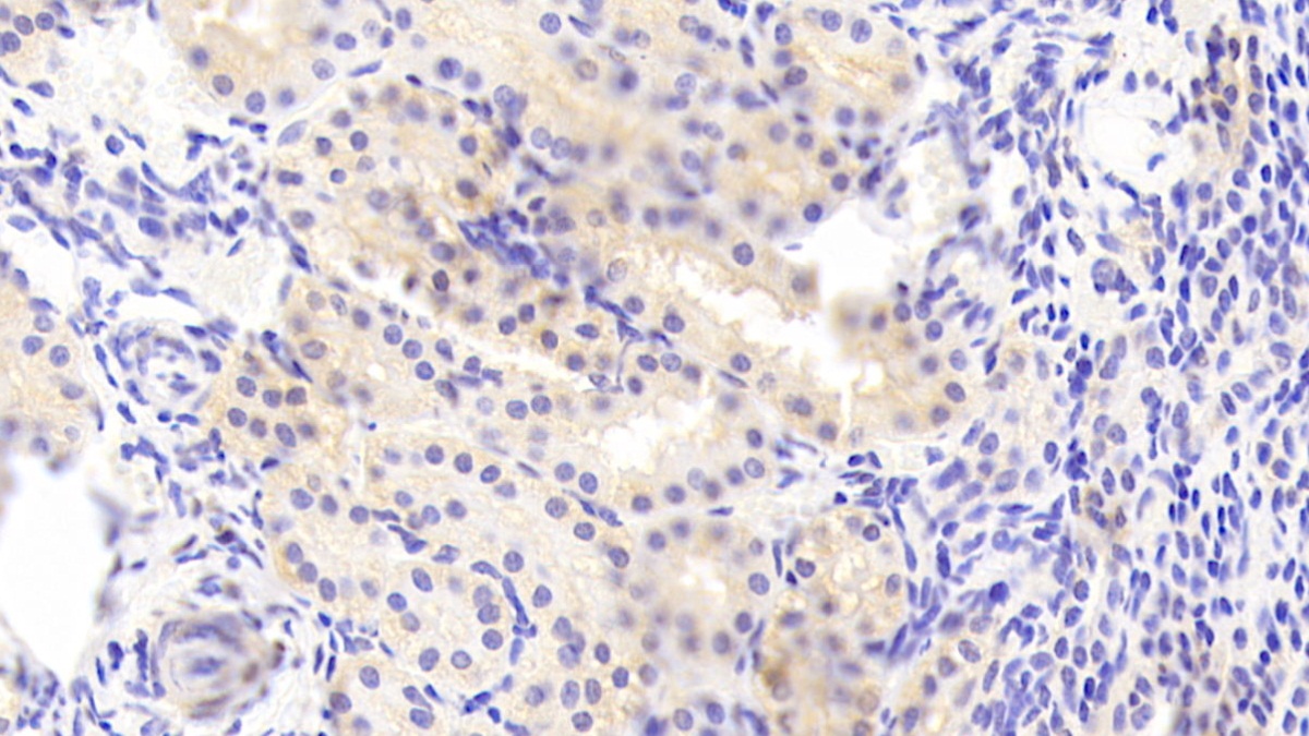 Polyclonal Antibody to C1q And Tumor Necrosis Factor Related Protein 1 (C1QTNF1)