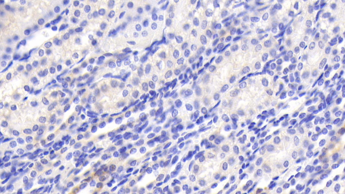 Polyclonal Antibody to RAB5A, Member RAS Oncogene Family (RAB5A)