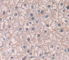 Polyclonal Antibody to Patched Homolog 1 (PTCH1)