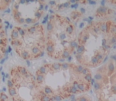 Polyclonal Antibody to Programmed Cell Death Protein 5 (PDCD5)