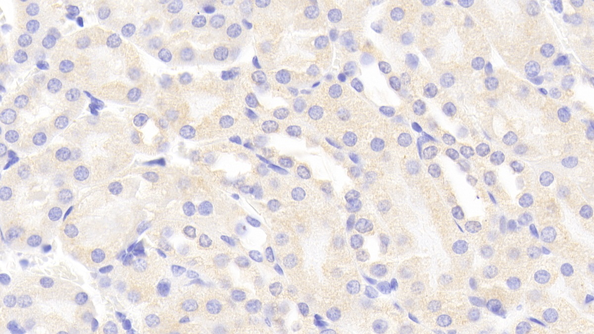 Polyclonal Antibody to Glial Cell Line Derived Neurotrophic Factor Receptor Alpha 1 (GFRa1)
