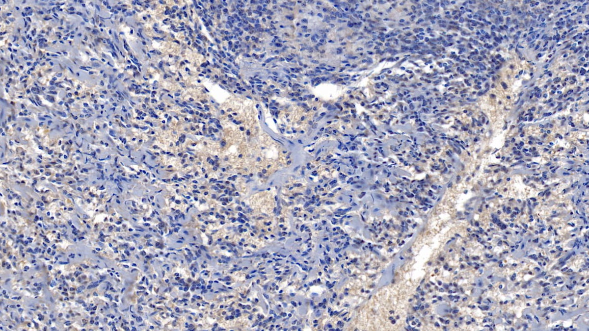 Polyclonal Antibody to Nuclear Factor Of Activated T-Cells, Cytoplasmic 2 (NFATC2)
