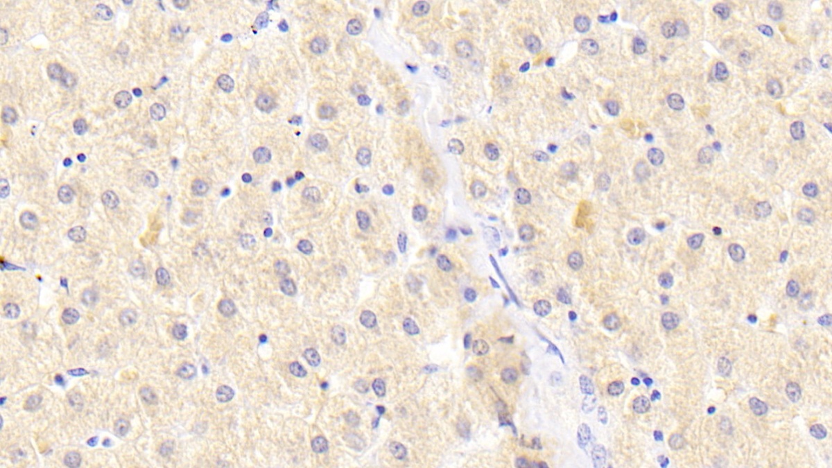 Polyclonal Antibody to Autophagy Related Protein 16 Like Protein 1 (ATG16L1)