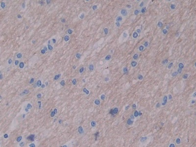 Polyclonal Antibody to Wingless Type MMTV Integration Site Family, Member 16 (WNT16)