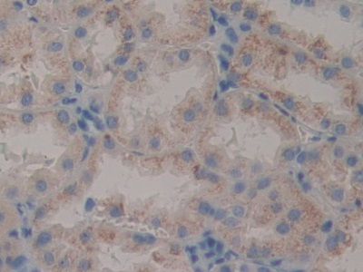 Polyclonal Antibody to Pim-2 Oncogene (PIM2)