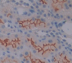 Polyclonal Antibody to Mucin 13, Cell Surface Associated (MUC13)