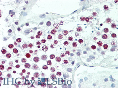 Polyclonal Antibody to Histone (H)