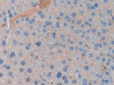 Polyclonal Antibody to Lipocalin 5 (LCN5)