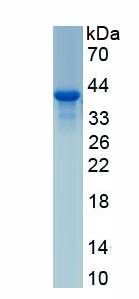 Active Tensin 1 (TNS1)
