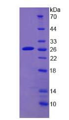 Active Cytochrome P450 2D6 (CYP2D6)