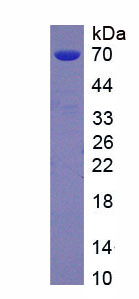 Active Eosinophil Peroxidase (EPX)