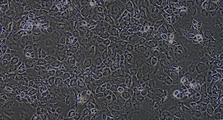 Primary Mouse Annulus Fibrosus Cells (AFC)