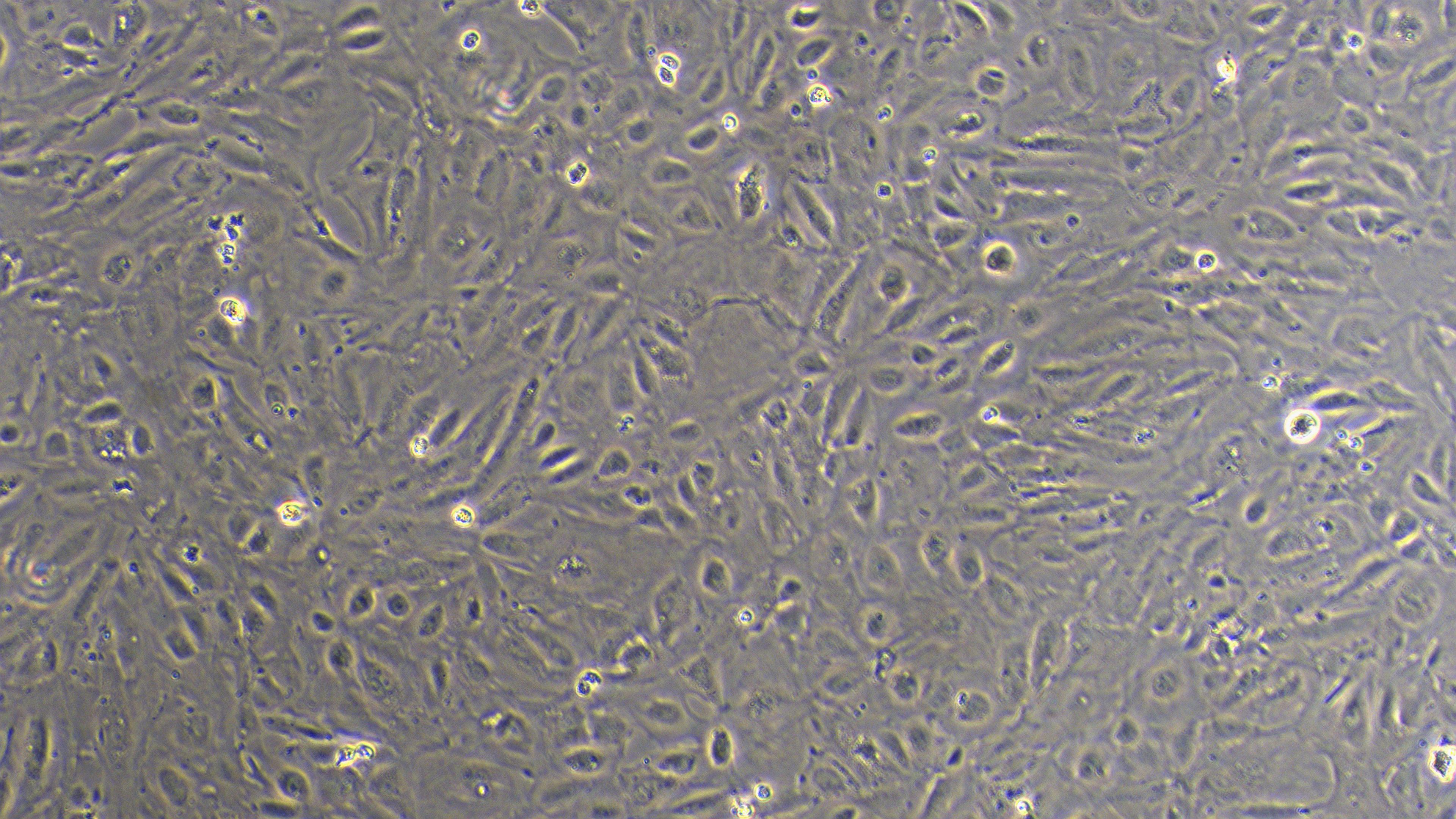 Primary Mouse Umbilical Vein Endothelial Cells (UVEC)