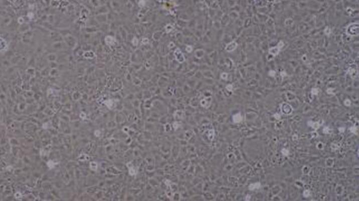 Primary Rat Bronchial Epithelial Cells (BEpiC)