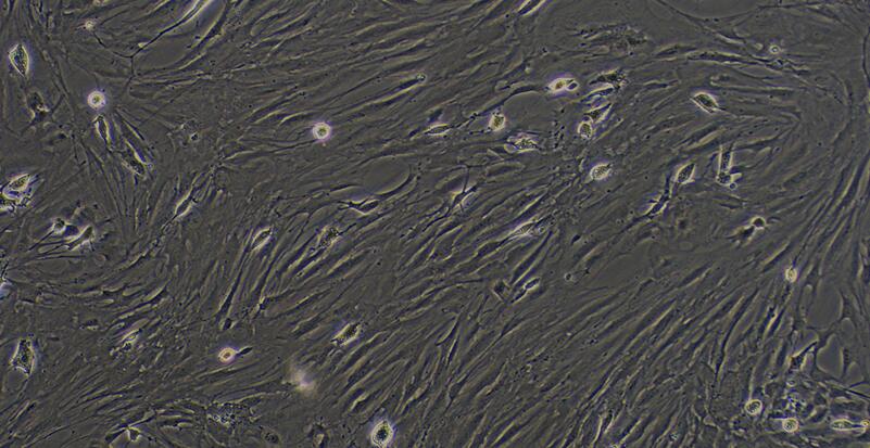 Primary Rat Trabecular Meshwork Cells (TMC)