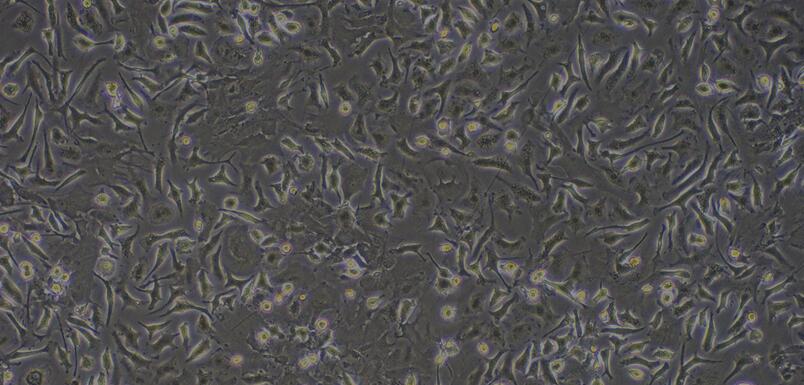 Primary Rat Hepatic Stellate Cells (HSC)