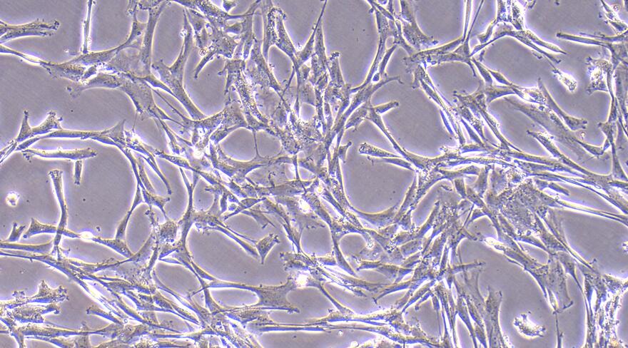 Primary Mouse Bone Marrow-derived Mesenchymal Stem Cells (BMMSCs)