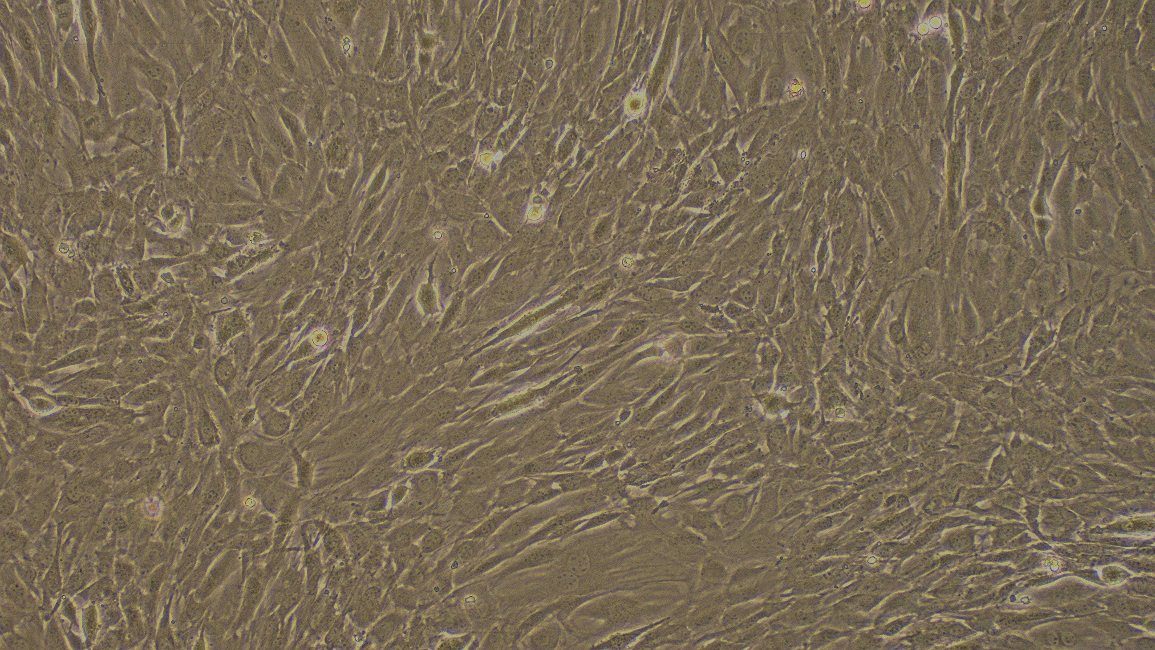 Primary Mouse Umbilical Vein Smooth Muscle Cells (UVSMC)