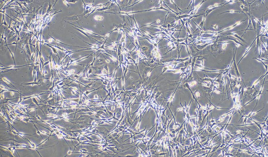 Primary Mouse Retinal Ganglion Cells  (RGC)