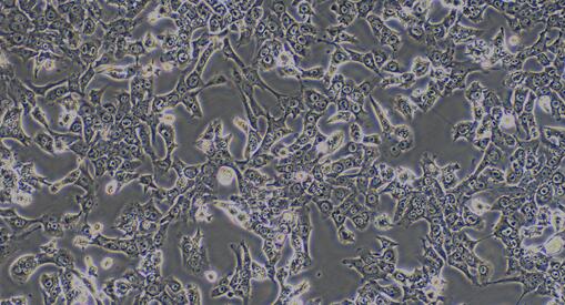 Mouse Hepatocellular Carcinoma Cells (HCC)