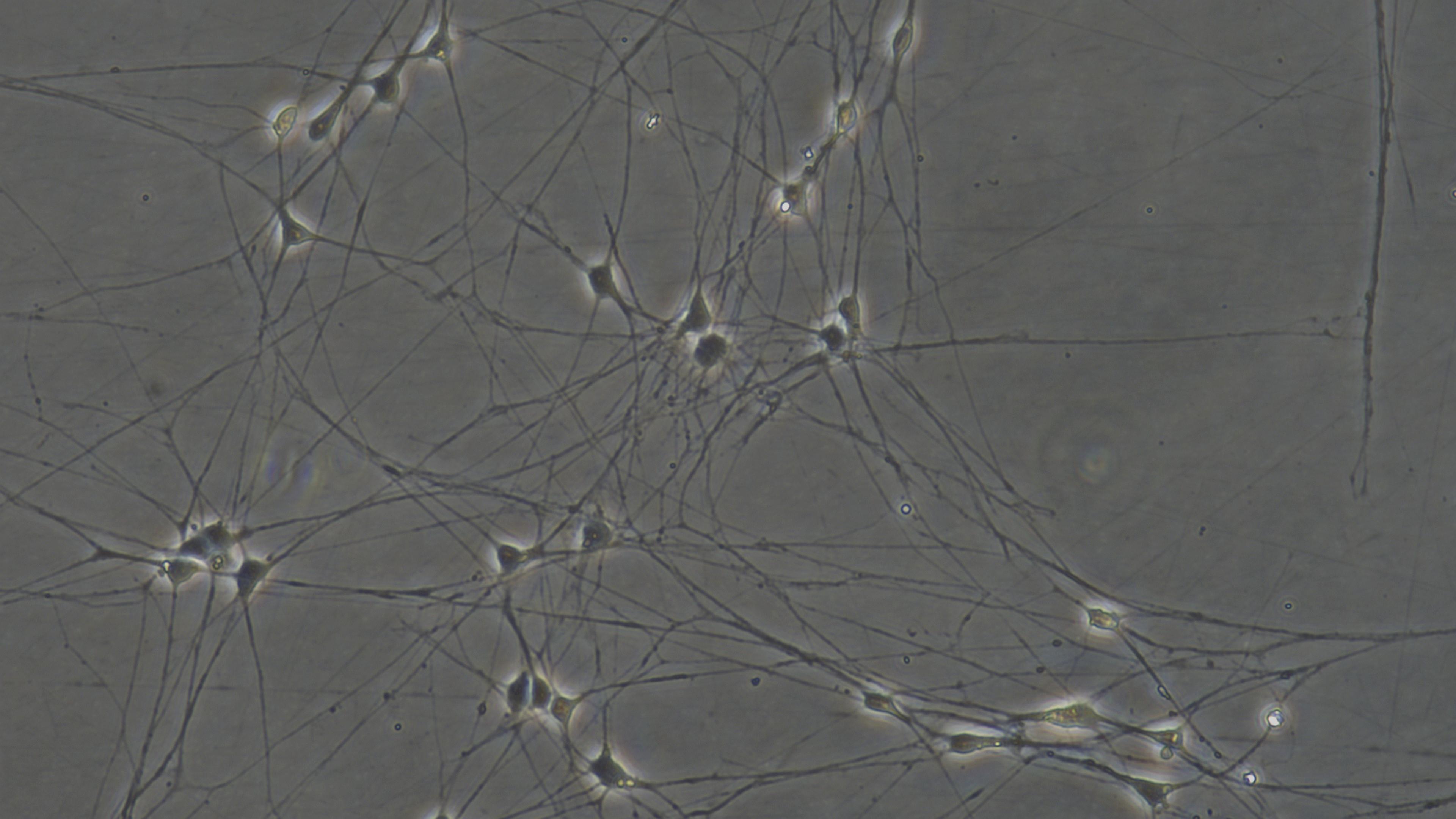 Primary Rat Trigeminal ganglion neuron cells (TGN)