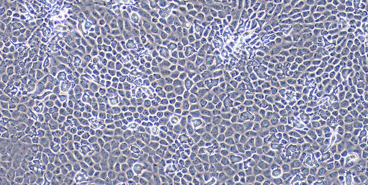 Primary Rat Ovarian Granulosa Cells (OGC)