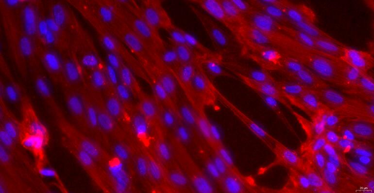 Primary Rabbit Ureteral Smooth Muscle Cells (USMC)