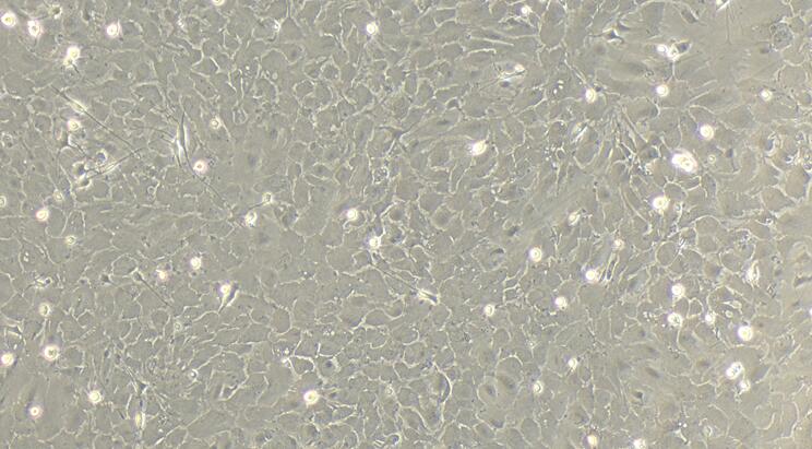 Primary Rat Olfactory Astrocytes (OA)