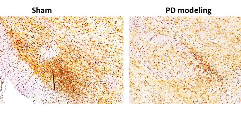 Mouse Model for Parkinson's Disease (PD)