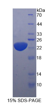 Eukaryotic Interleukin 11 (IL11)