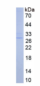 Eukaryotic Heat Shock Protein 27 (Hsp27)