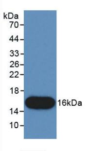 Monoclonal Antibody to Connective Tissue Growth Factor (CTGF)