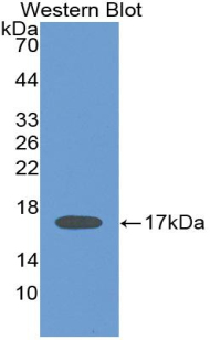 Monoclonal Antibody to Interleukin 2 (IL2)