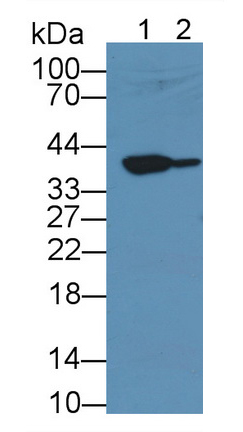 Monoclonal Antibody to Matrix Metalloproteinase 13 (MMP13)