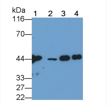 Monoclonal Antibody to Creatine Kinase, Muscle (CKM)