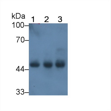 Monoclonal Antibody to Creatine Kinase, Muscle (CKM)