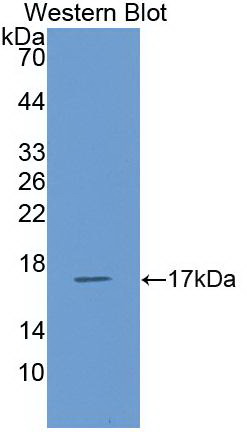 Monoclonal Antibody to Regulated On Activation In Normal T-Cell Expressed And Secreted (RANTES)