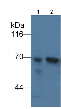 Monoclonal Antibody to Alpha-Fetoprotein (AFP)