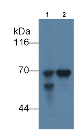 Monoclonal Antibody to Alpha-Fetoprotein (AFP)