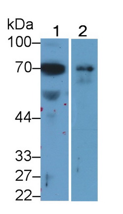 Monoclonal Antibody to Alpha 2-Antiplasmin (a2PI)