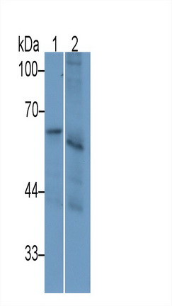 Monoclonal Antibody to Interleukin 2 Receptor Beta (IL2Rb)
